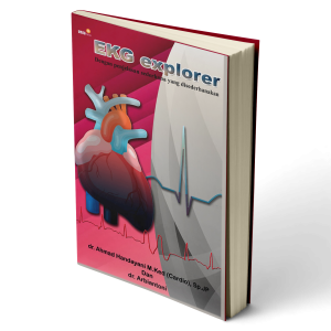 EKG Explorer